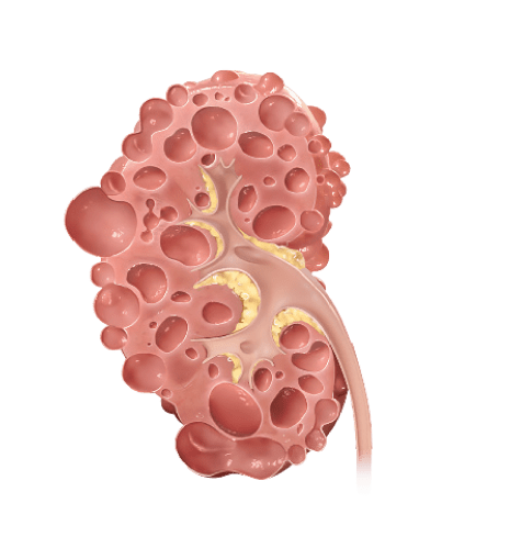 Kidney 3