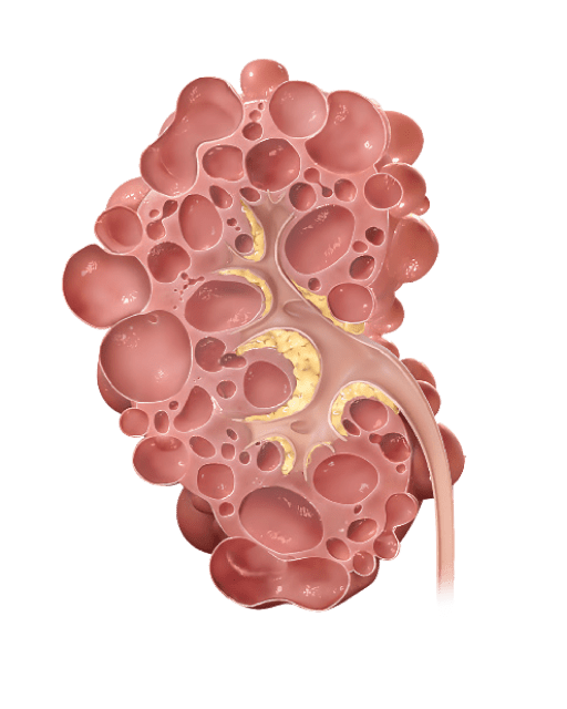 Kidney 4