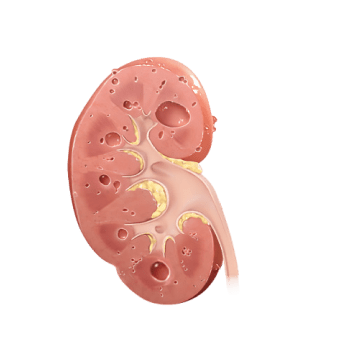 Kidney 1