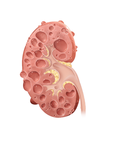 Kidney 2